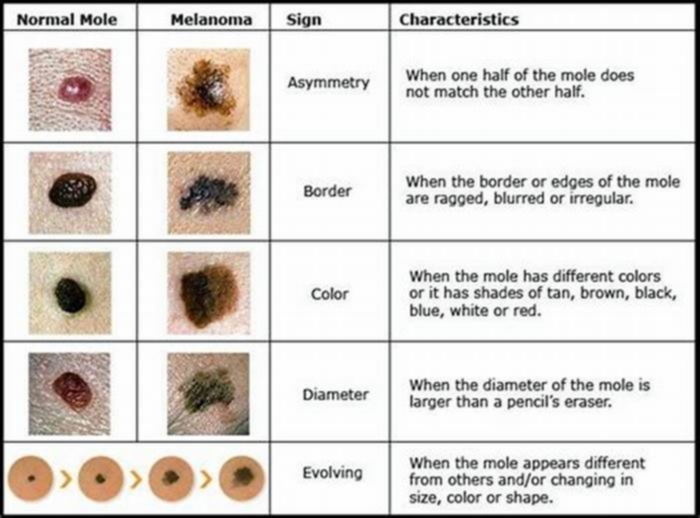 Are black moles normal on dogs?