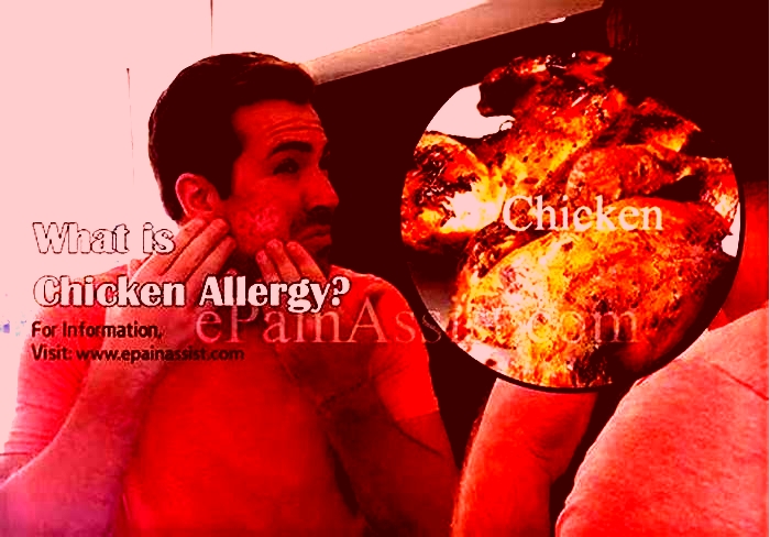 Can chicken trigger allergies?