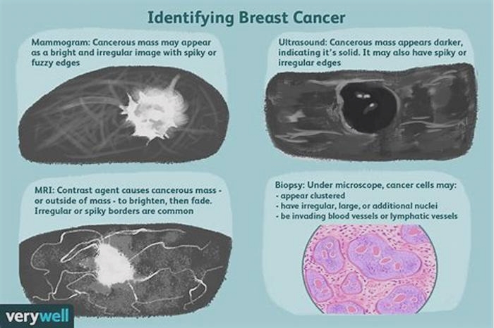 How can I tell if a lump is cancerous?